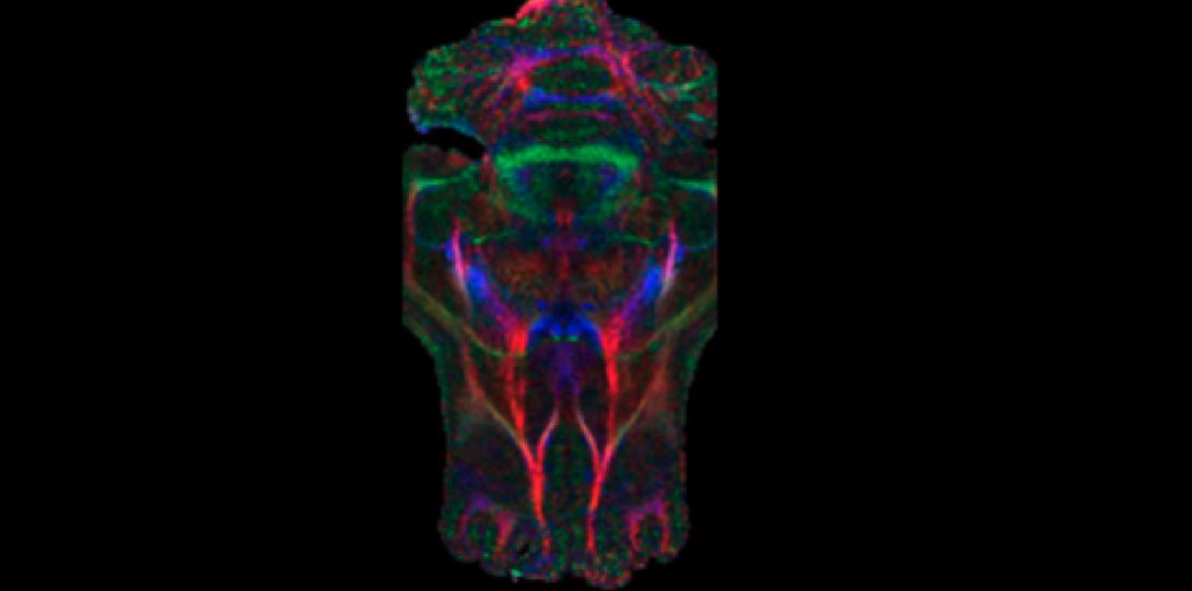 Brain nerve DTI